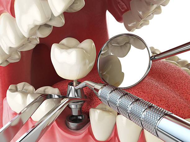 Best Broken or Cracked Tooth Emergency Dentist in Senatobia, MS